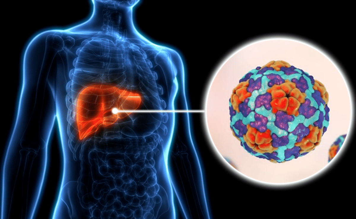 Hepatitis A outbreak
